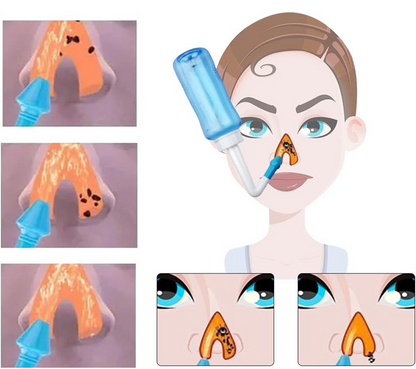 HOUDIAN Neti Pot irrigador nasal para niños y adultos 2 boquillas 300 ml