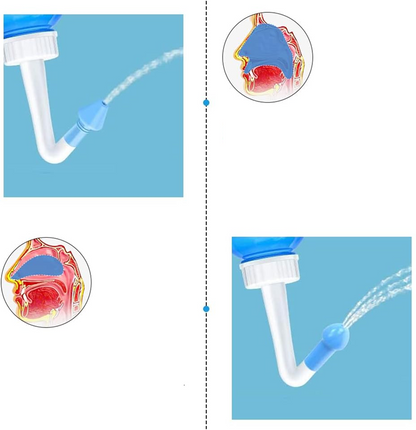 HOUDIAN Neti Pot irrigador nasal para niños y adultos 2 boquillas 300 ml